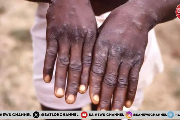 मंकीपॉक्स: भारत में  स्वास्थ्य आपातकाल घोषित