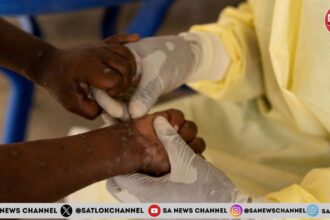 Breaking the Stigma Around Mpox Quick Facts You Should Know