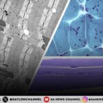 What is Nemaline Myopathy