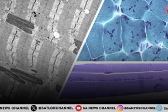 What is Nemaline Myopathy