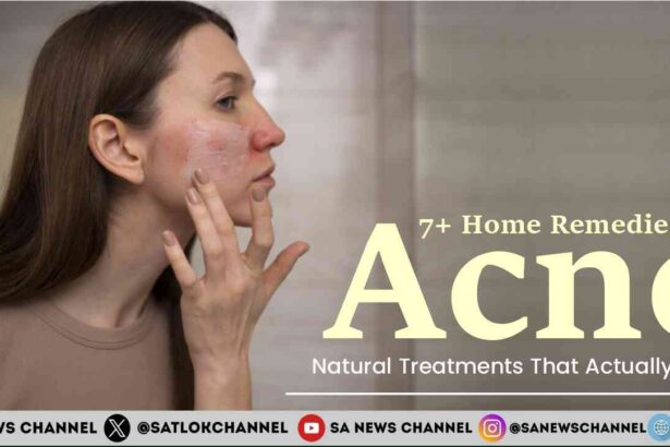 7+ Home Remedies for Acne Natural Treatments That Actually Work