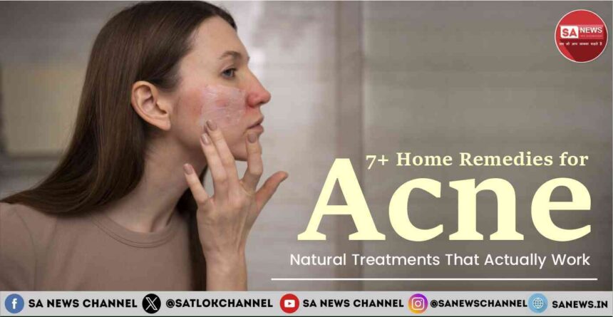 7+ Home Remedies for Acne Natural Treatments That Actually Work