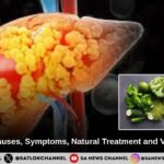 Fatty Liver: Causes, Symptoms, Natural Treatment and Vegetarian Diet