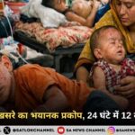 बांग्लादेश में खसरे का भयानक प्रकोप, 24 घंटे में 12 बच्चों की मौत