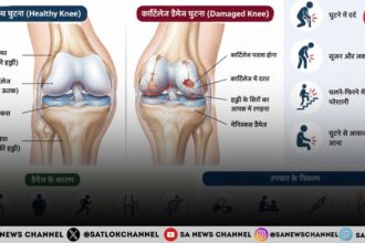 कार्टिलेज डैमेज के शुरुआती लक्षण, कारण और बचाव