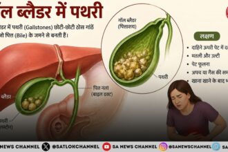 गॉल ब्लैडर की पथरी लक्षण, कारण, जांच, इलाज और बचाव के उपाय