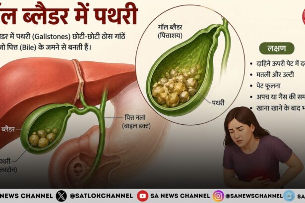गॉल ब्लैडर की पथरी लक्षण, कारण, जांच, इलाज और बचाव के उपाय