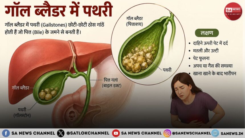 गॉल ब्लैडर की पथरी लक्षण, कारण, जांच, इलाज और बचाव के उपाय