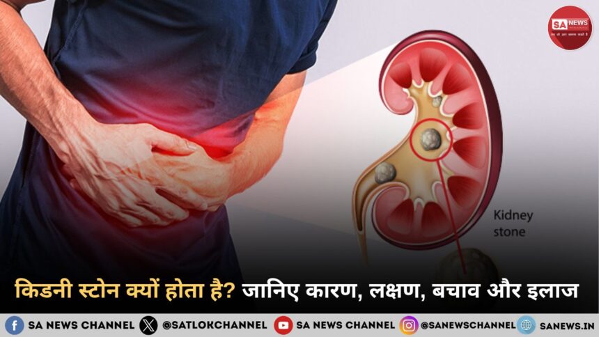 क्यों होता है किडनी स्टोन? जानिए कारण, लक्षण और बचाव के तरीके