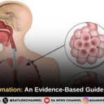 Lung Inflammation: An Evidence-Based Guide for Patients