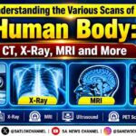 Understanding the Various Scans of the Human Body: CT, X-Ray, MRI and More